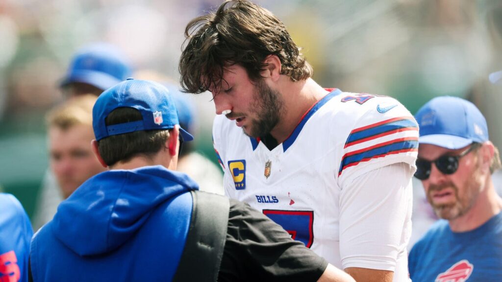 Bills QB Josh Allen plans to wear visor vs. Dolphins after suffering bloody nose in Week 2
